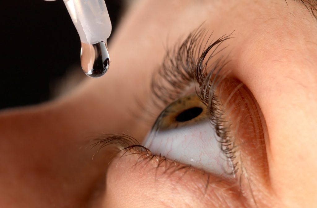 Close up of women putting in Atropine Drops (eye drops) to stop myopia from getting worse