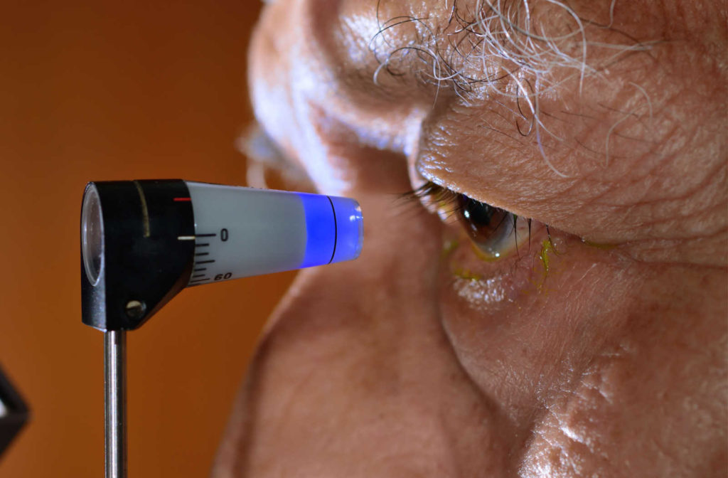 A senior patient is undergoing an eye pressure test with the use of a tonometer placed close to the eye by an optometrist.