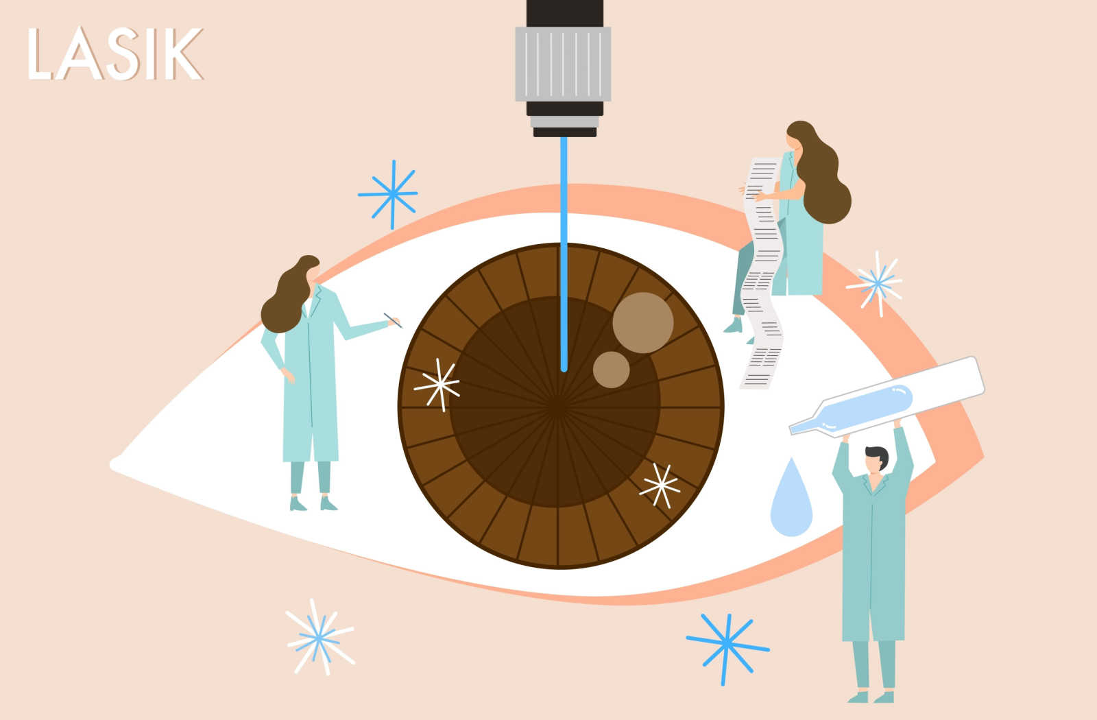 A vector image of an eyeball being treated with a laser with three small optical technicians around it.